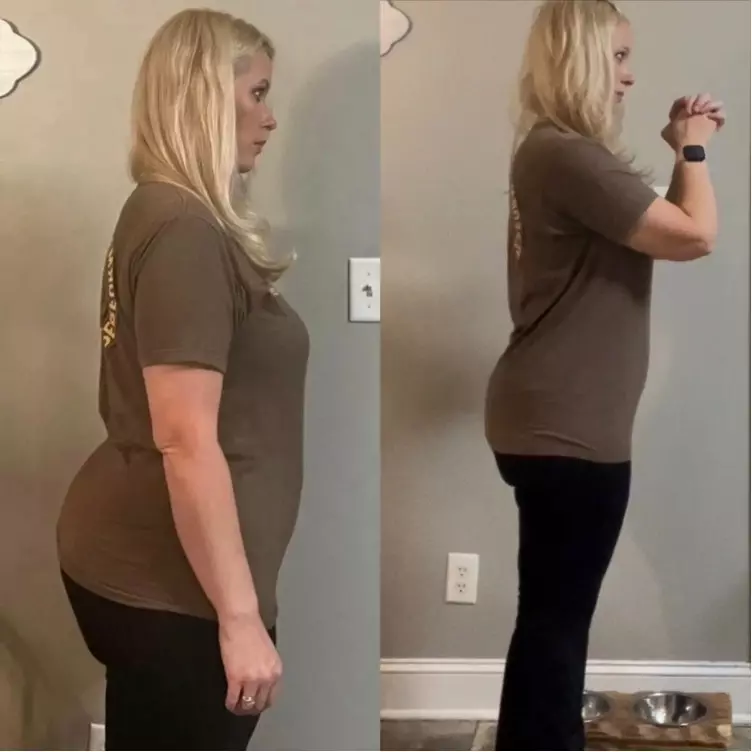 Lisa M. before and after